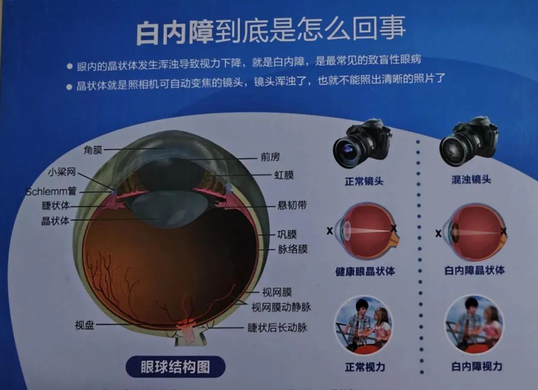 ，简单的相信，抹涂 1个半月3支眼膏后，眼睛越来越明亮了!-康瞳护眼膏-圣原大健康助力，让每个家庭都能享受清晰视界的守护