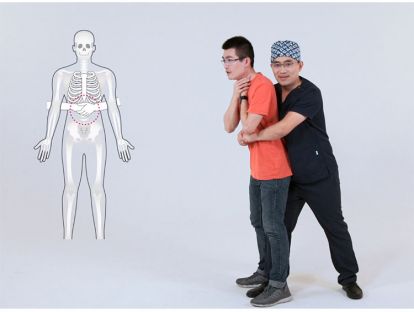 8.气道异物梗阻急救法（成人&儿童）