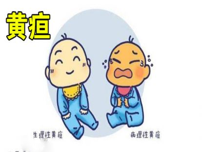 孩子黄疸一定要停止吃母乳吗？