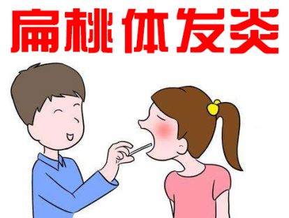 急性扁桃体发炎，这个方法比点滴管用的多！