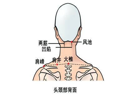 糖尿病伴随肩颈痛的自我保健