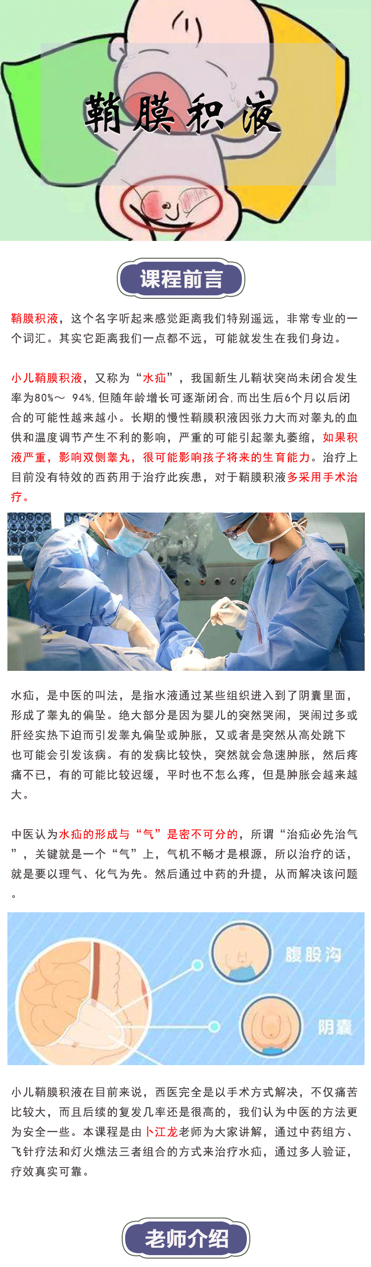 【绝招汇】鞘膜积液/水疝