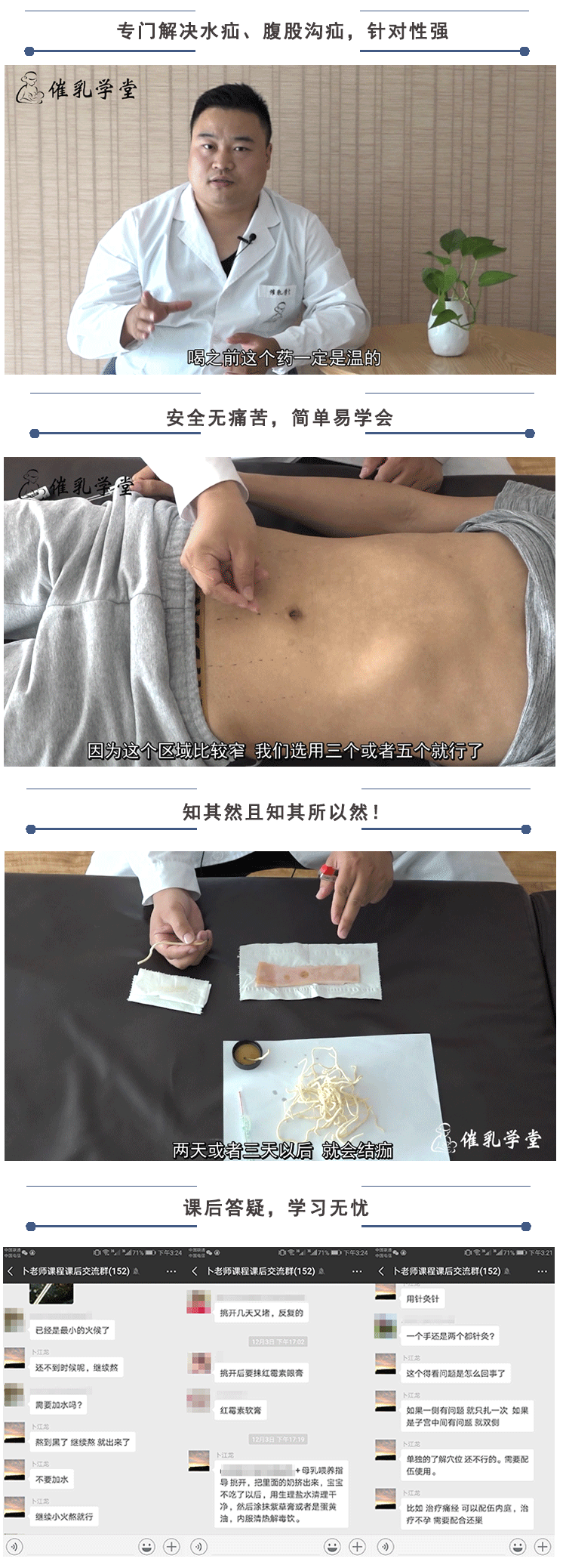【绝招汇】鞘膜积液/水疝