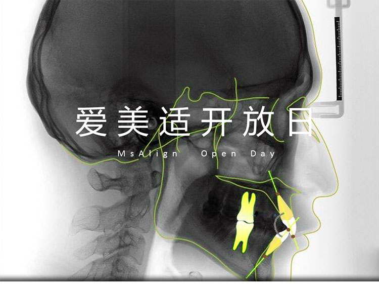 爱美适开放日第1季