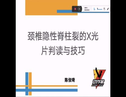颈椎隐形脊椎裂的X光片判读与技巧