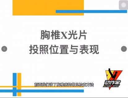 胸椎X光片投照位置与表现