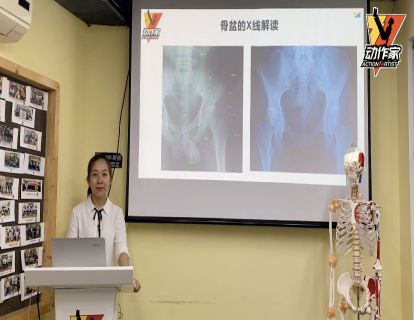 骨盆美学综合评估之X光片判读