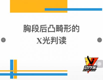 胸椎后凸畸形的X光判读