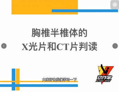 胸椎半椎体的X光片与CT片判读