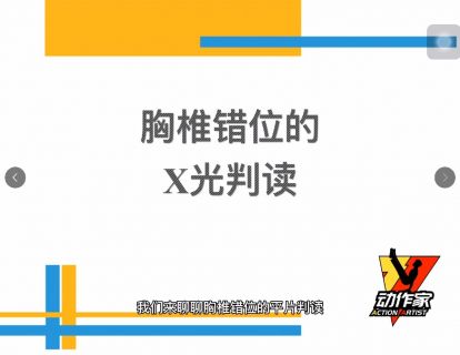 胸椎错位的X光片判读
