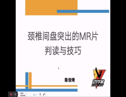颈椎间盘突出的MR片判读与技巧