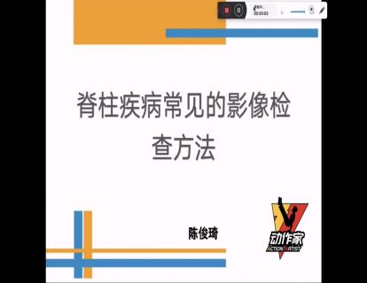 脊柱疾病的常见影像学检查方法
