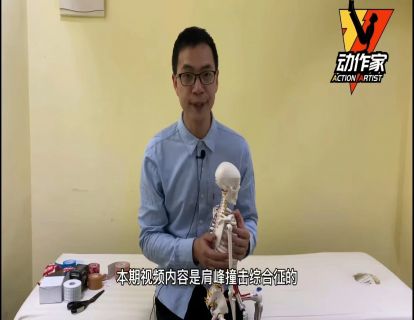肩峰撞击综合征