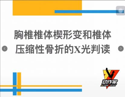 胸椎椎体楔形变和椎体压缩性骨折的X光判读