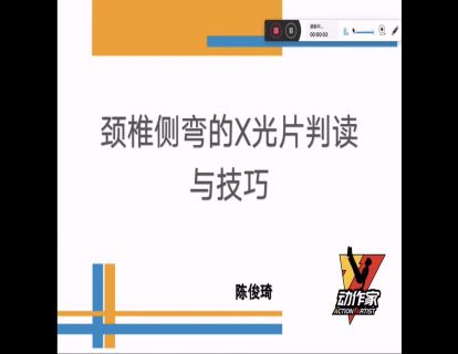 颈椎侧弯的的X光片判读与技巧