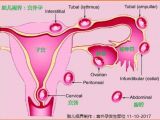 小心宫外孕