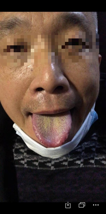 鲍艳举--经方治疗发热专题