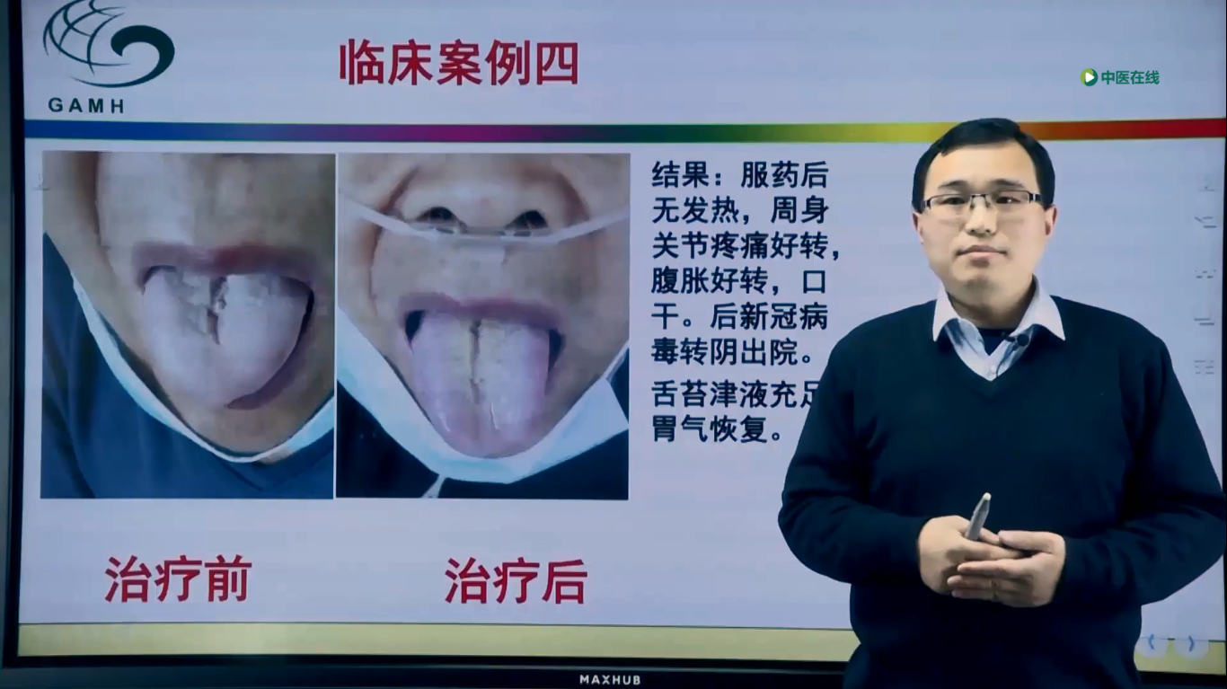 鲍艳举--经方治疗发热专题