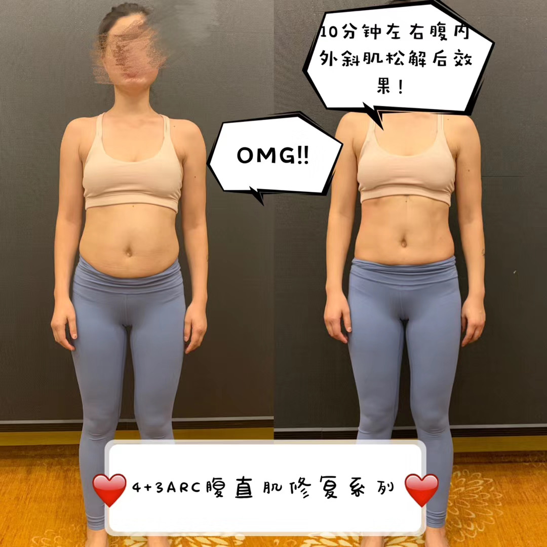 腹直肌分离?不要再收收收了!50+颠覆产后瑜伽圈的松解、激活与训练,别再上智商税了!