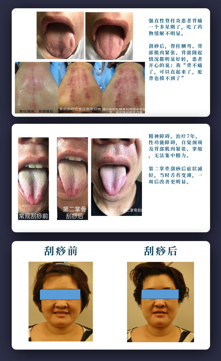 张秀勤亲授：全息经络刮痧入门 - 开启健康金钥匙