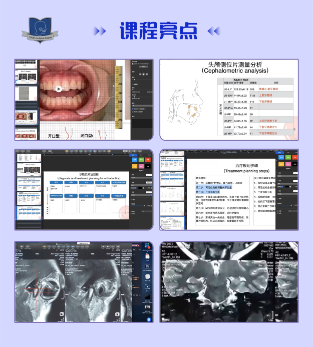 一阶段-诊断及矫治方案制定-【轻松学】小白跟我学正畸系列