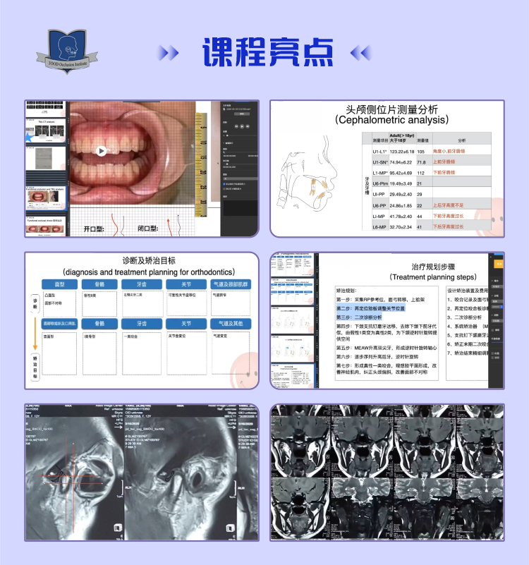二阶段-矫治辅助技术-【轻松学】小白跟我学正畸系列