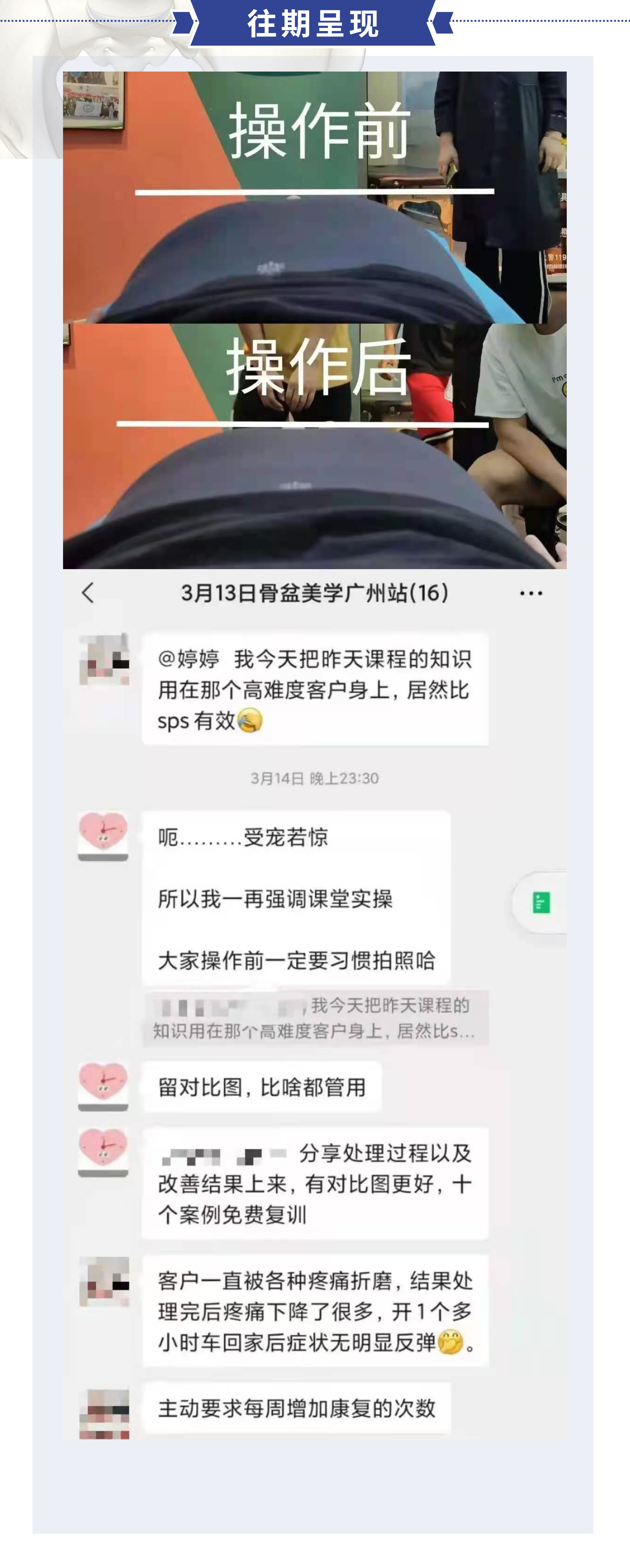 一门简单高效的骨盆调整课程——骨盆美学